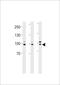 Enhancer Of Polycomb Homolog 1 antibody, LS-C203965, Lifespan Biosciences, Western Blot image 