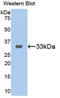 GRB2 Related Adaptor Protein 2 antibody, LS-C294331, Lifespan Biosciences, Western Blot image 