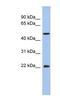 Progressive ankylosis protein homolog antibody, NBP1-59748, Novus Biologicals, Western Blot image 