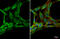 Platelet Derived Growth Factor Receptor Alpha antibody, GTX133620, GeneTex, Immunofluorescence image 