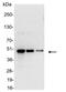 VSIV Glycoprotein G antibody, 18874P, QED Bioscience, Western Blot image 