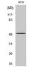 Histone methyltransferase SMYD2 antibody, PA5-51063, Invitrogen Antibodies, Western Blot image 