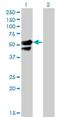 AP2 Associated Kinase 1 antibody, H00022848-M02, Novus Biologicals, Western Blot image 