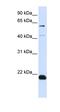 Chromosome 14 Open Reading Frame 180 antibody, orb325164, Biorbyt, Western Blot image 