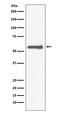 Tyrosine Hydroxylase antibody, M01917, Boster Biological Technology, Western Blot image 