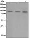 Hyaluronan Mediated Motility Receptor antibody, ab124729, Abcam, Western Blot image 