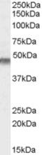 Potassium Voltage-Gated Channel Subfamily J Member 11 antibody, LS-B3250, Lifespan Biosciences, Western Blot image 