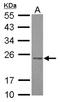 RAB3B, Member RAS Oncogene Family antibody, NBP2-20045, Novus Biologicals, Western Blot image 