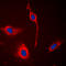 EPH Receptor A6 antibody, LS-B14564, Lifespan Biosciences, Immunofluorescence image 