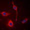 Ephrin type-A receptor 6 antibody, LS-B14564, Lifespan Biosciences, Immunofluorescence image 