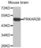 Protein Kinase CAMP-Dependent Type II Regulatory Subunit Beta antibody, abx002367, Abbexa, Western Blot image 