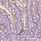 Retinoic acid-induced protein 3 antibody, NBP1-89743, Novus Biologicals, Immunohistochemistry paraffin image 