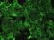 Tumor Associated Calcium Signal Transducer 2 antibody, GTX01991, GeneTex, Immunofluorescence image 