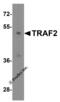 TNF Receptor Associated Factor 2 antibody, 3661, ProSci, Western Blot image 