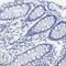 Nebulin antibody, PA5-53457, Invitrogen Antibodies, Immunohistochemistry frozen image 