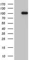 Histone-lysine N-methyltransferase NSD3 antibody, M32443, Boster Biological Technology, Western Blot image 