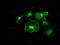 Fyn Related Src Family Tyrosine Kinase antibody, GTX84481, GeneTex, Immunofluorescence image 