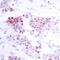 Myocyte Enhancer Factor 2A antibody, GTX50398, GeneTex, Immunohistochemistry paraffin image 
