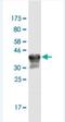 CPN3 antibody, H00008895-M02-100ug, Novus Biologicals, Western Blot image 