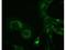 Replicase polyprotein 1a antibody, M19765, Boster Biological Technology, Immunofluorescence image 