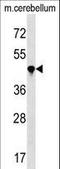 Peptidylprolyl Isomerase Like 4 antibody, LS-C158707, Lifespan Biosciences, Western Blot image 