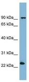 VPS29 Retromer Complex Component antibody, ab98929, Abcam, Western Blot image 