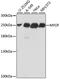 Myoferlin antibody, A15427, ABclonal Technology, Western Blot image 