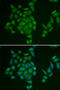Adenosine Monophosphate Deaminase 3 antibody, abx004856, Abbexa, Western Blot image 