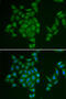 AMP deaminase 3 antibody, abx004856, Abbexa, Western Blot image 