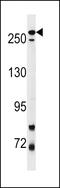 Leucine Rich Repeat Kinase 2 antibody, 62-661, ProSci, Western Blot image 