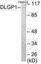 DLG Associated Protein 1 antibody, EKC1620, Boster Biological Technology, Western Blot image 