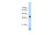 Eukaryotic Translation Initiation Factor 2 Subunit Alpha antibody, 29-326, ProSci, Immunohistochemistry frozen image 