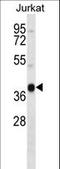  antibody, LS-C158099, Lifespan Biosciences, Western Blot image 