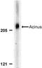 Apoptotic chromatin condensation inducer in the nucleus antibody, NBP1-76856, Novus Biologicals, Western Blot image 