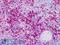 Myeloperoxidase antibody, LS-B4741, Lifespan Biosciences, Immunohistochemistry paraffin image 