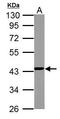NADH:Ubiquinone Oxidoreductase Subunit A10 antibody, TA308313, Origene, Western Blot image 