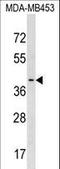 Platelet Activating Factor Acetylhydrolase 2 antibody, LS-C158524, Lifespan Biosciences, Western Blot image 