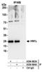 Jupiter Microtubule Associated Homolog 2 antibody, A304-664A, Bethyl Labs, Immunoprecipitation image 