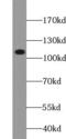 Phosphatidylinositol-4,5-Bisphosphate 3-Kinase Catalytic Subunit Alpha antibody, FNab06417, FineTest, Western Blot image 