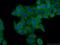 Transforming Growth Factor Beta Induced antibody, 10188-1-AP, Proteintech Group, Immunofluorescence image 