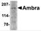 Autophagy And Beclin 1 Regulator 1 antibody, 4557, ProSci, Western Blot image 