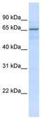 Zinc Finger Protein 256 antibody, TA342437, Origene, Western Blot image 