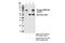 ALK Receptor Tyrosine Kinase antibody, 14678S, Cell Signaling Technology, Immunoprecipitation image 