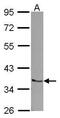 Ring Finger And CHY Zinc Finger Domain Containing 1 antibody, PA5-30963, Invitrogen Antibodies, Western Blot image 