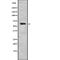 Hyaluronan Binding Protein 2 antibody, abx215809, Abbexa, Western Blot image 