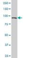 Elongin A antibody, H00006924-M02, Novus Biologicals, Western Blot image 