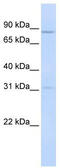 Protein O-mannosyl-transferase 1 antibody, TA335942, Origene, Western Blot image 