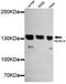 Histone Deacetylase 4 antibody, MBS475081, MyBioSource, Western Blot image 
