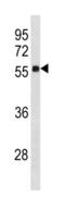 Zinc Finger Protein 502 antibody, abx034732, Abbexa, Western Blot image 