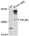 DnaJ Heat Shock Protein Family (Hsp40) Member B2 antibody, abx125766, Abbexa, Western Blot image 